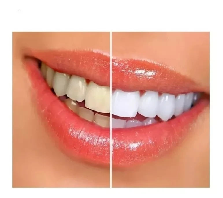 Lapiz Blanqueador Dental Instantáneo